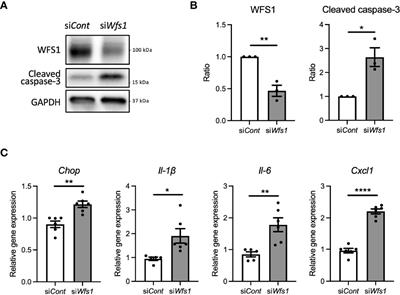 Loss of Function of WFS1 Causes ER Stress-Mediated Inflammation in Pancreatic Beta-Cells